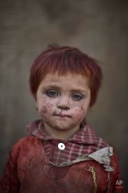 In this Friday, Jan. 24, 2014 photo, Afghan refugee girl, Gul Bibi Shamra, 3, poses for a picture, while playing with other children in a slum on the outskirts of Islamabad, Pakistan. (AP Photo/Muhammed Muheisen)