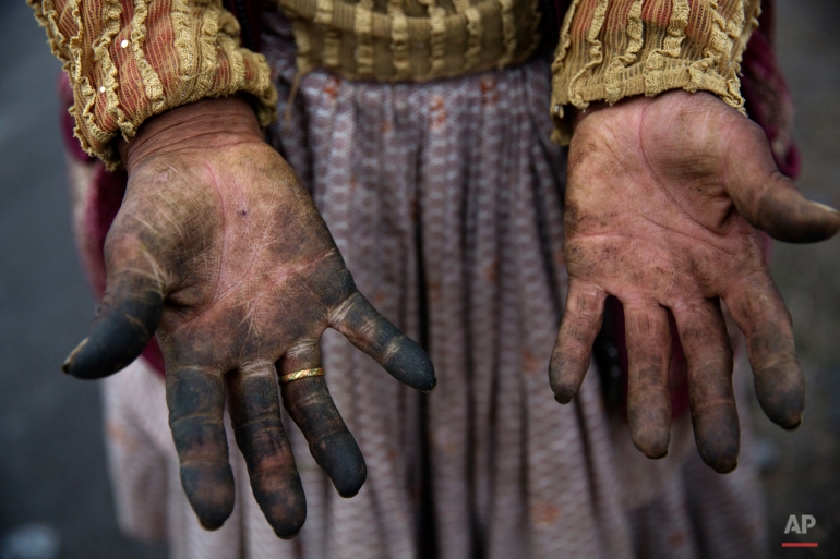In this May 29, 2015 photo, day laborer Victoria Apasa, 72, shows her muddied hands from harvesting tomatoes in the Tambo Valley, Arequipa, Peru. "Here life is peaceful. He who works, even if he lacks an education, gets ahead. Why would we want a mine?" says farmer Domingo Condori. (AP Photo/Rodrigo Abd)