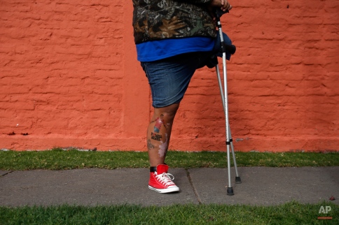 Soccer fan Paulo Valdes, who has an image of Chile's Gary Medel tattooed on his right leg, stands outside the Juan Pinto Duran sporting complex, in hopes that he will be able to obtain a free ticket to the Copa America final, in Santiago, Chile, Wednesday, July 1, 2015. (AP Photo/Luis Hidalgo)